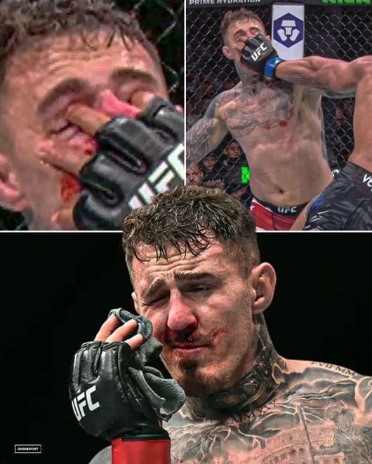 UFC関連の写真