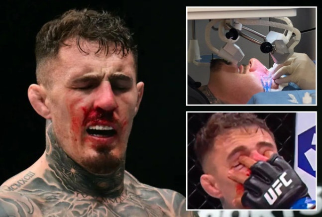 UFC関連の写真