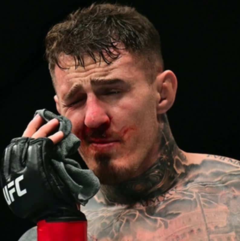 Was It Intentional? Tom Aspinall Breaks Silence on Brutal Eye Injury